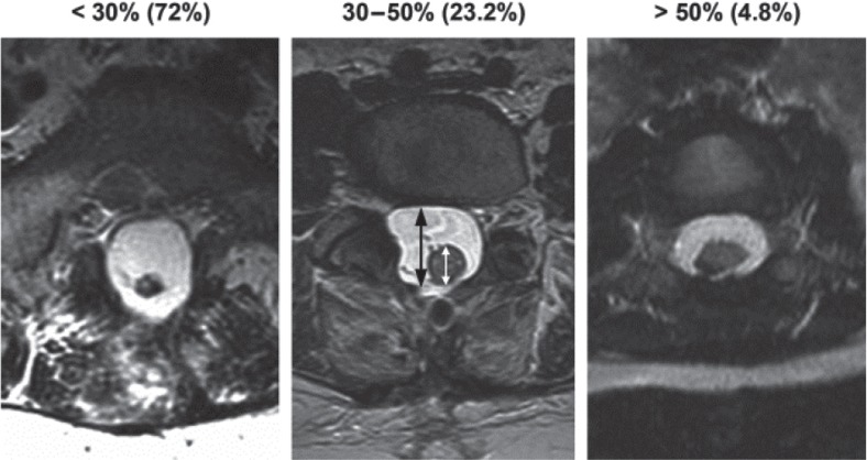 Fig. 45