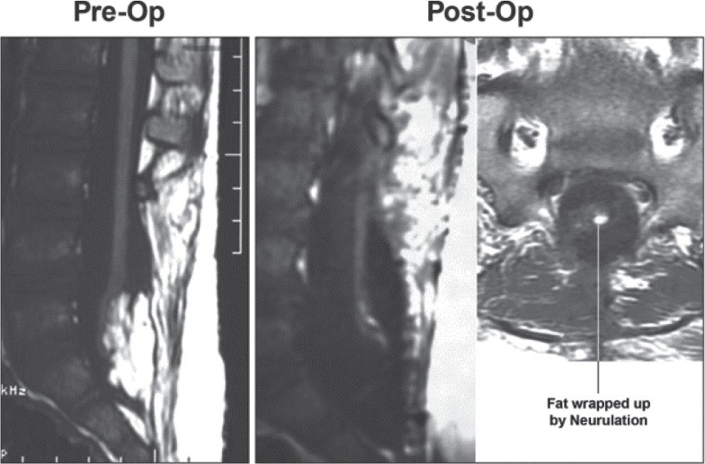 Fig. 44