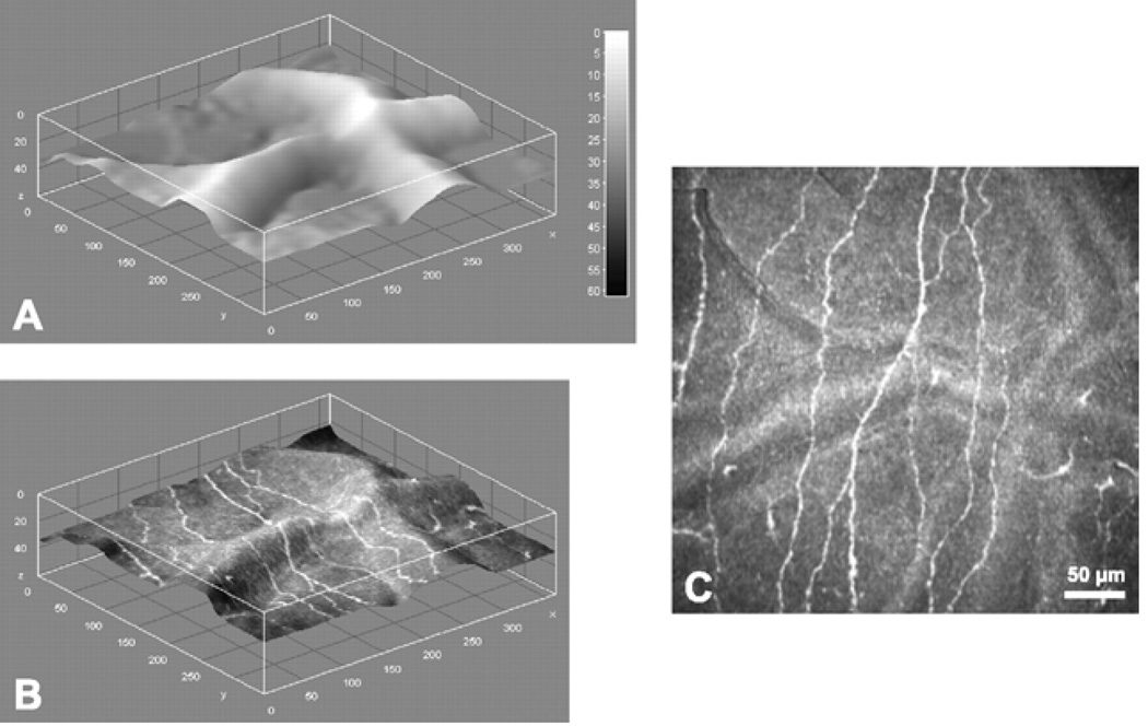 Figure 11