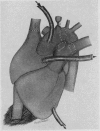 93