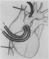 95