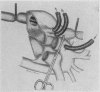 95