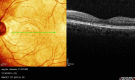Fig. 11