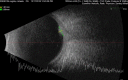 Fig. 12