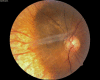 Fig. 9
