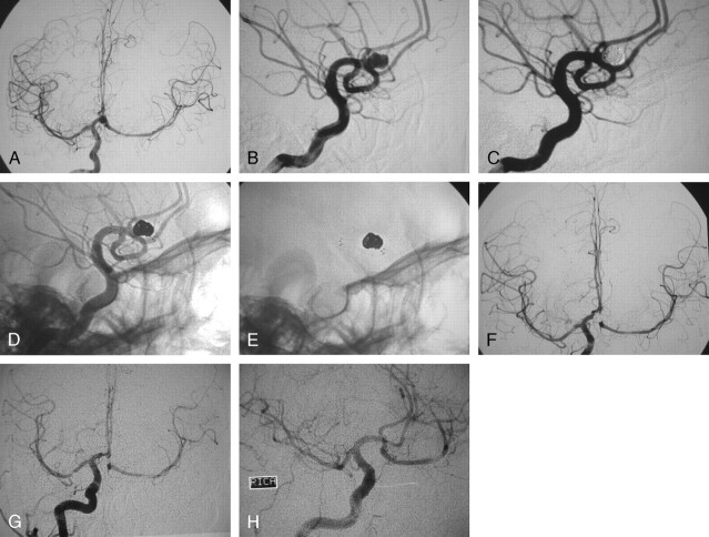 Fig 2.