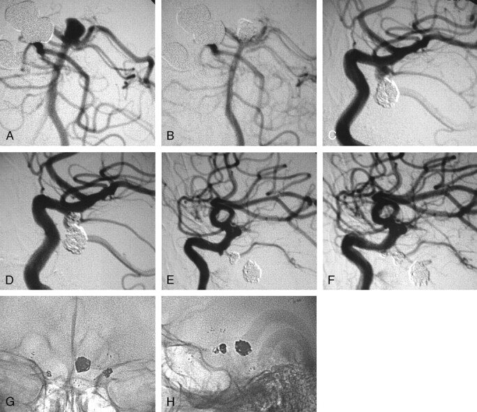 Fig 3.