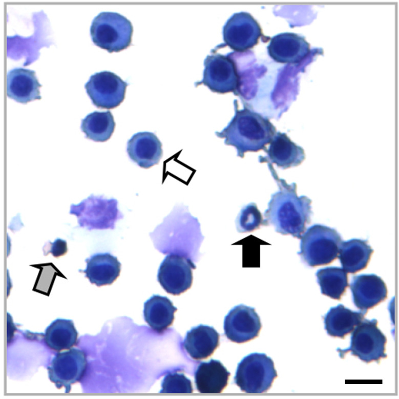 Murine Bronchoalveolar Lavage - PMC