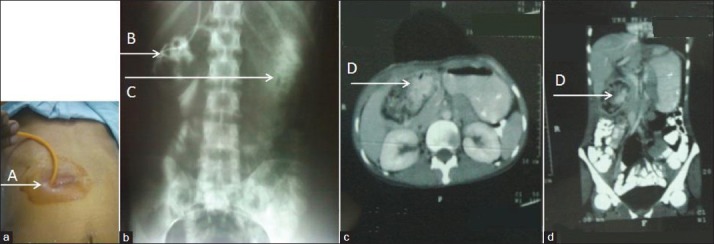 Figure 5, Case 2