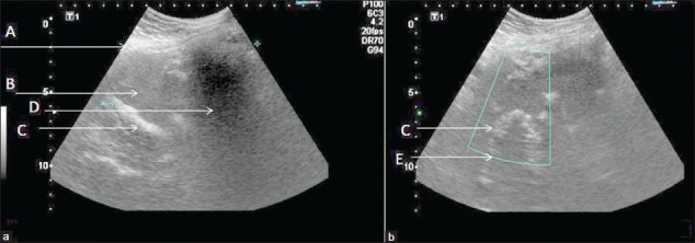 Figure 1, Case 1