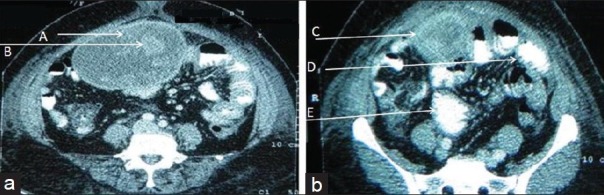 Figure 2, Case 1