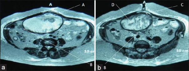 Figure 3, Case 1