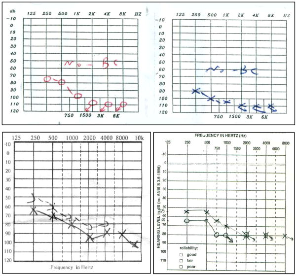 FIG. 3