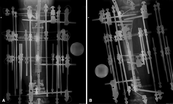 Fig. 4A–B