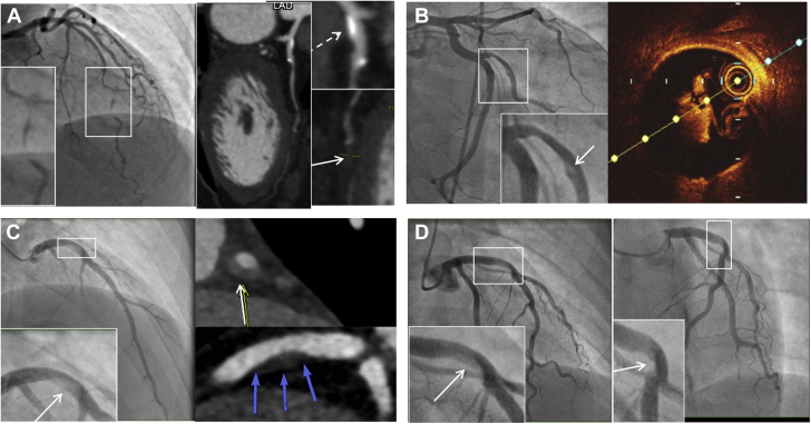 Figure 4