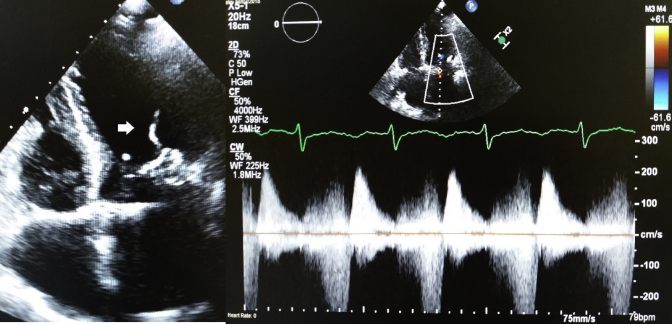 Figure 1