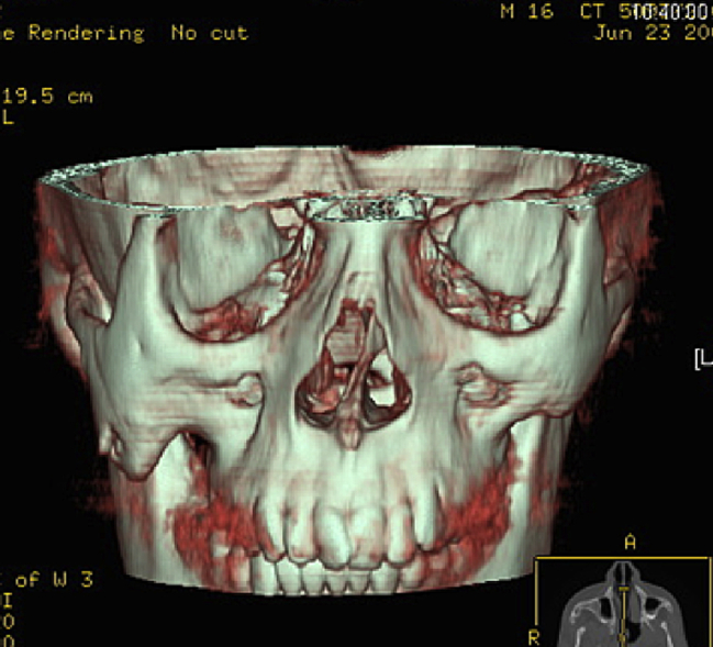 Fig. 7