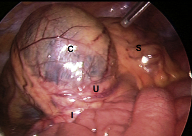 Fig. 2