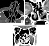 FIG 1