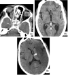 FIG 8