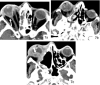 FIG 7
