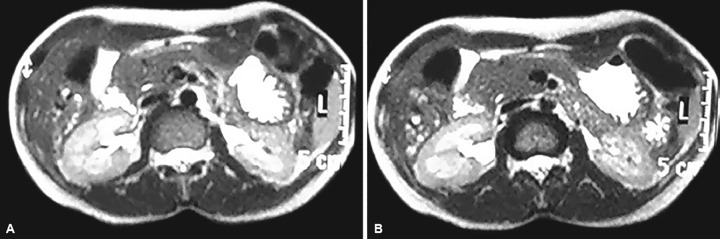 Figs 2A and B: