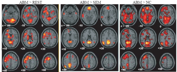 Fig. (1)