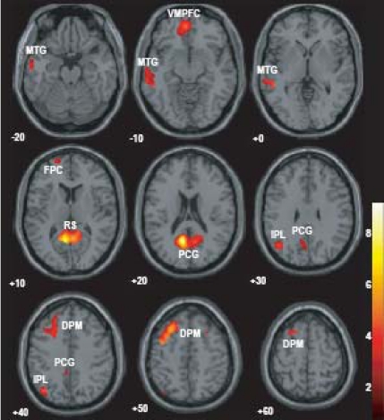 Fig. (4)