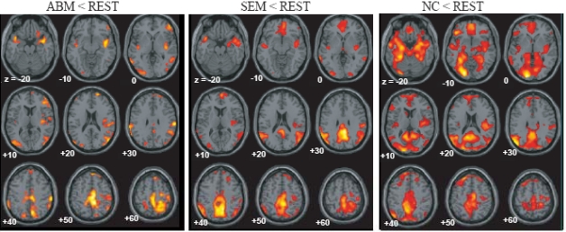 Fig. (2)