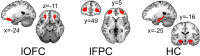 Figure 2—figure supplement 1.