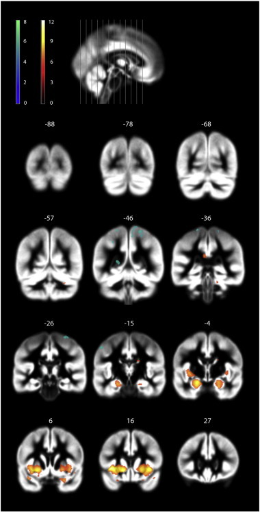 Fig. 1