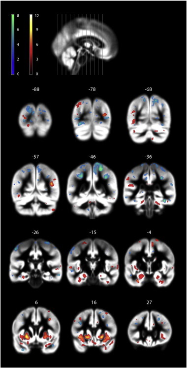 Fig. 2