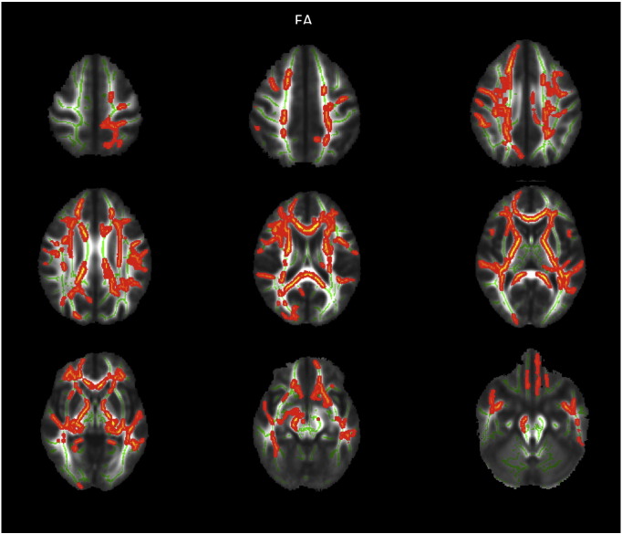 Supplementary Fig. 4