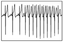 graphic file with name bioengineering-05-00035-i007.jpg