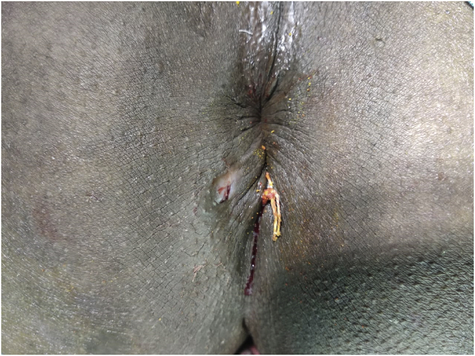 Fig. 3