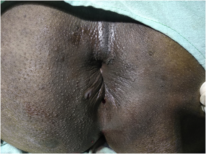 Fig. 4