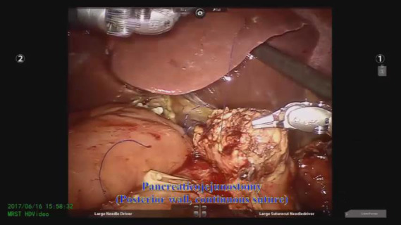 Video 2