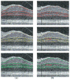 Fig. 10