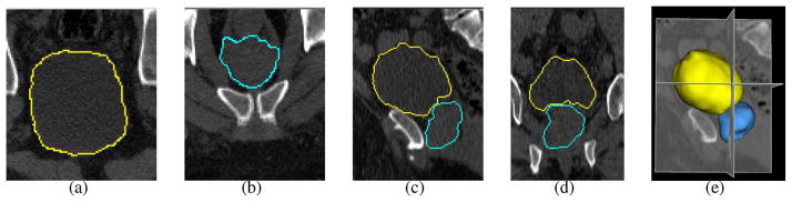 Fig. 12