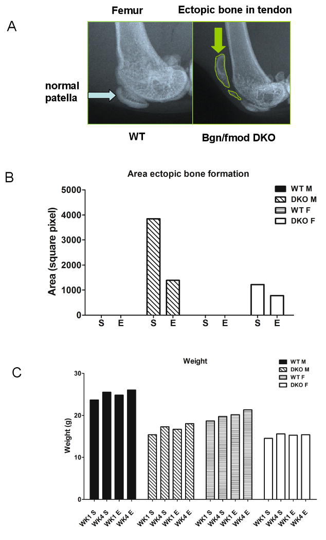 Biglycan (Bgn) and fibromodulin (Fmod) in ectopic ossification of ...