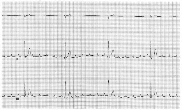 FIG. 1