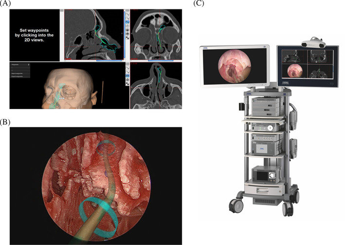 FIGURE 1