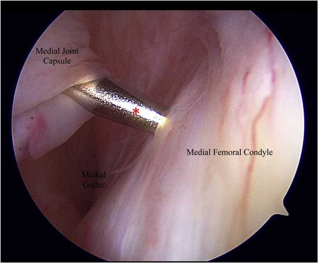 Fig 14