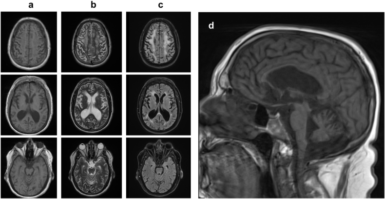 Fig. 1