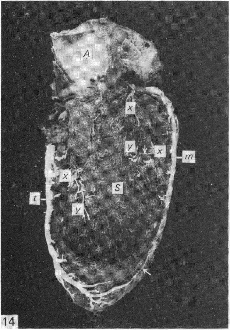 Fig. 14