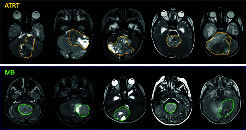 FIG 3.