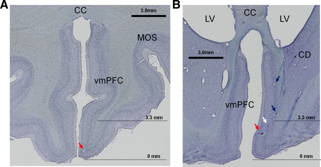 Figure 14.