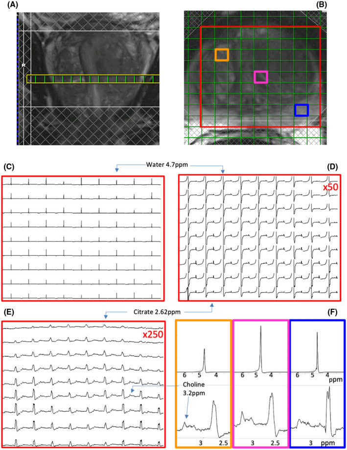 FIGURE 2