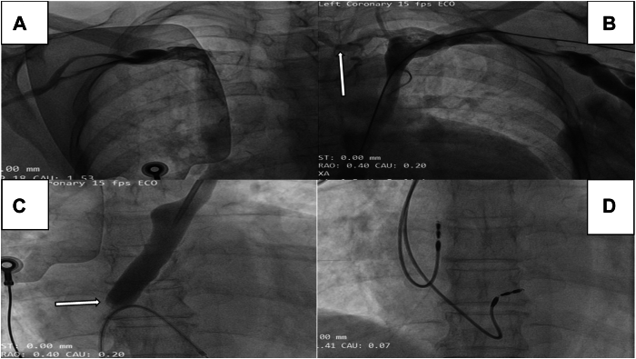 Figure 2