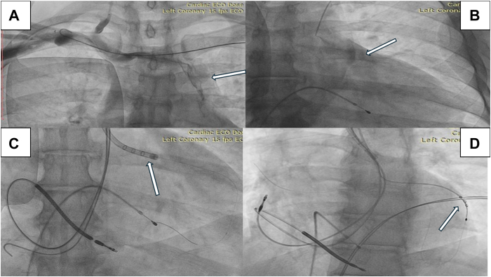 Figure 3